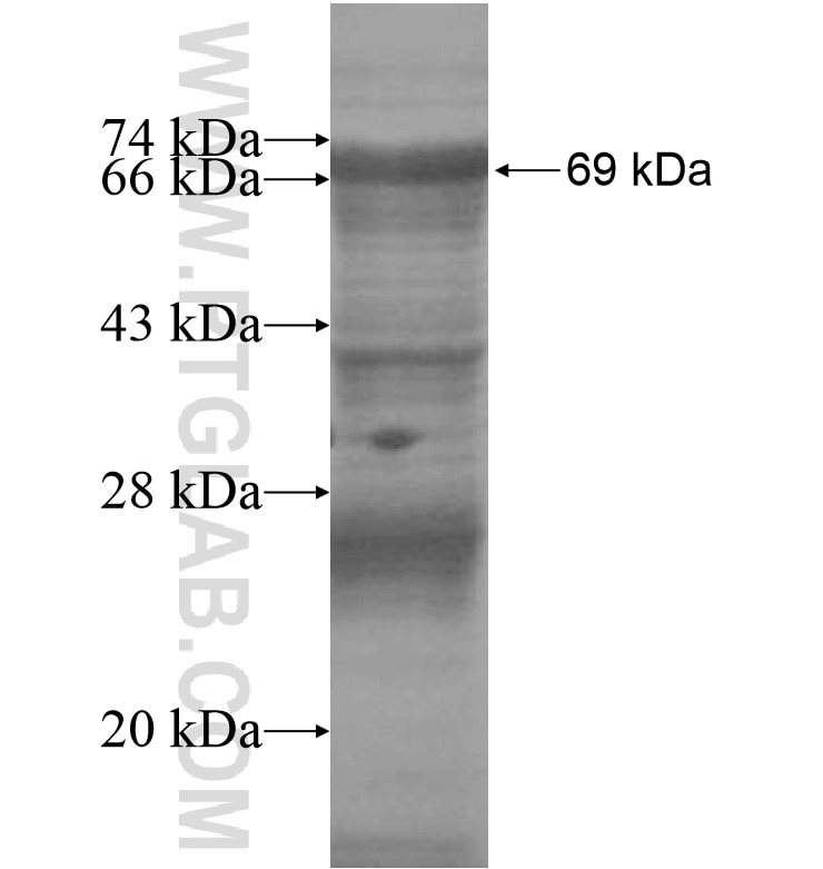 ZNF518A fusion protein Ag16405 SDS-PAGE ZNF518A fusion protein Ag16405 SDS-PAGE