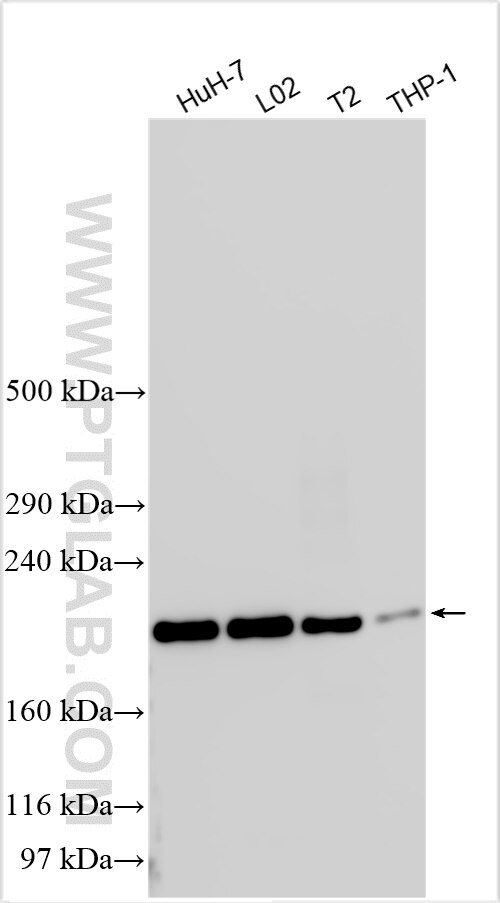 Western Blot (WB) analysis of various lysates using ZNF521 Polyclonal antibody (23716-1-AP)