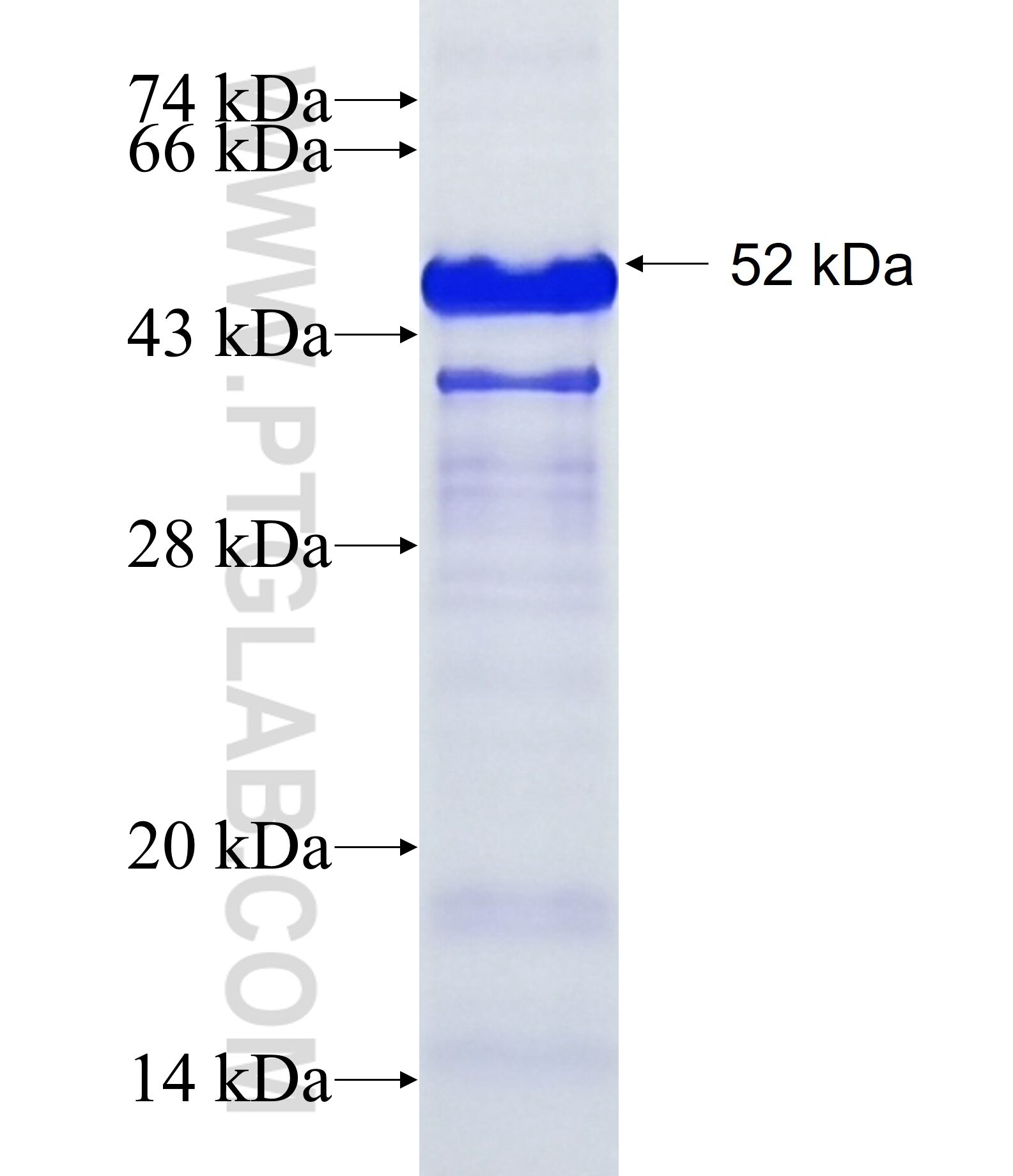 ZNF521 fusion protein Ag20540 SDS-PAGE
