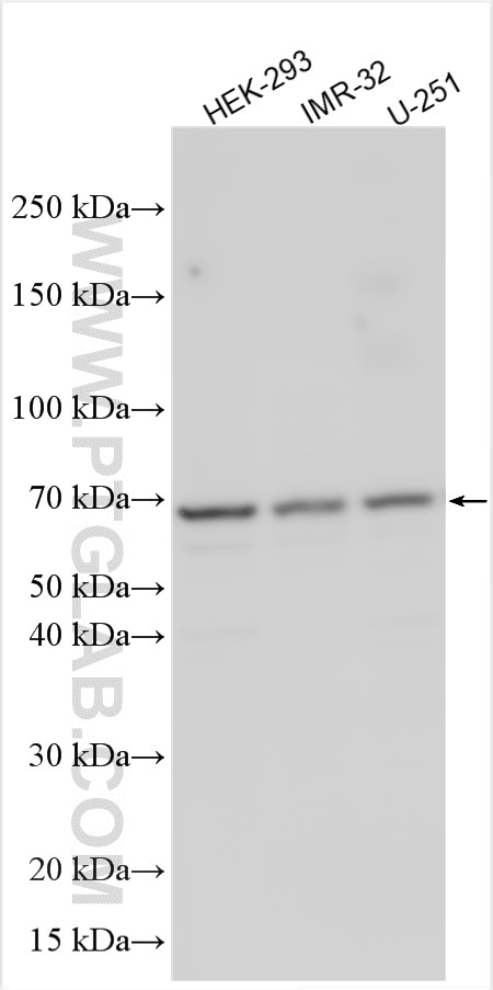 WB analysis using 32288-1-AP Western Blot (WB) analysis of various lysates using ZNF530 Polyclonal antibody (32288-1-AP)