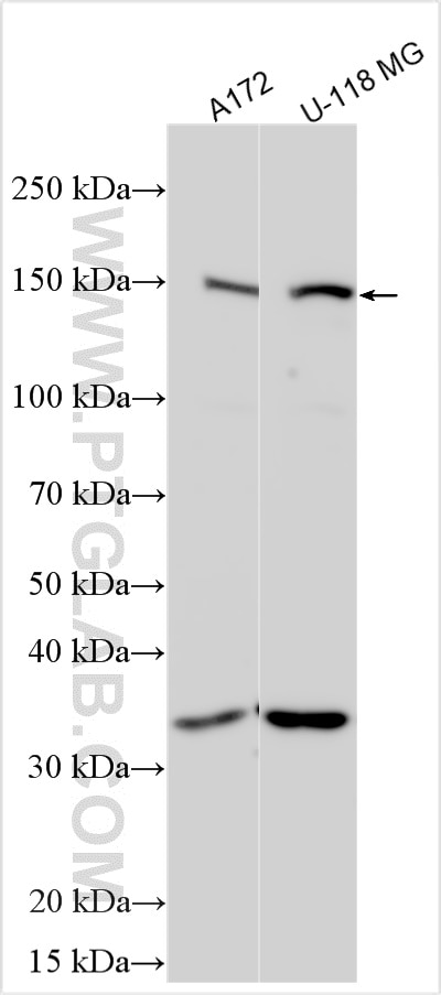Western Blot (WB) analysis of various lysates using ZNF536 Polyclonal antibody (21317-1-AP)