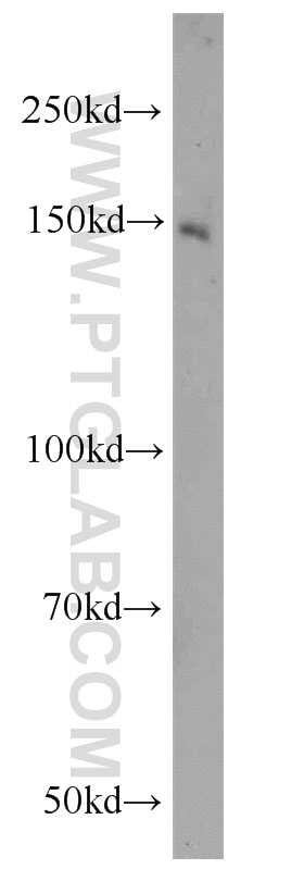 Western Blot (WB) analysis of HeLa cells using ZNF541 Polyclonal antibody (21873-1-AP)