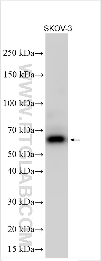 Western Blot (WB) analysis of various lysates using ZNF543 Polyclonal antibody (21365-1-AP)