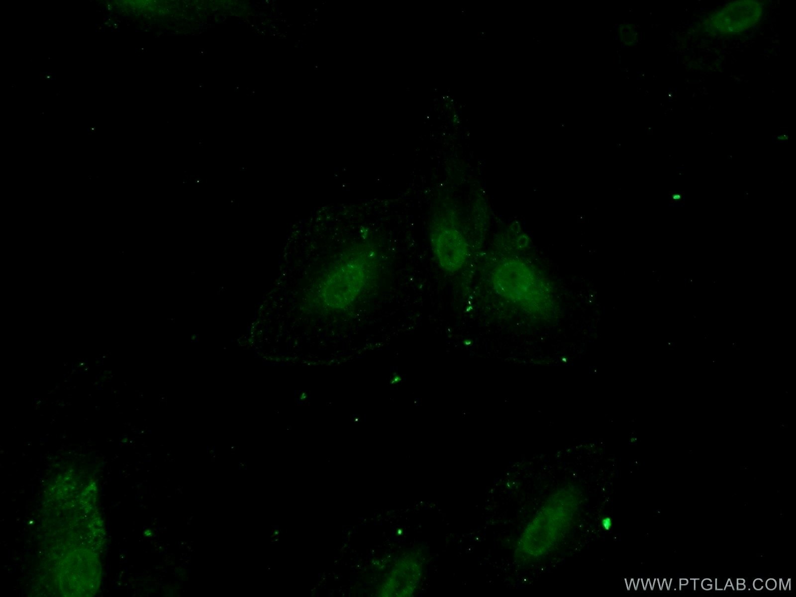 Immunofluorescence (IF) / fluorescent staining of A549 cells using ZNF549 Polyclonal antibody (25592-1-AP)