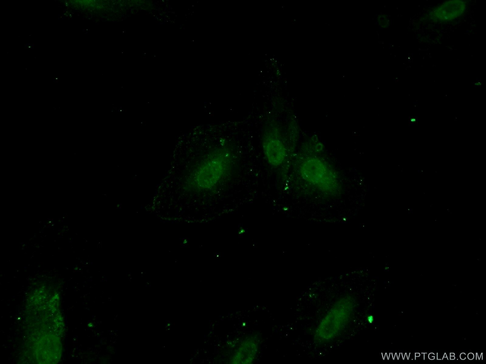 IF Staining of A549 using 25592-1-AP