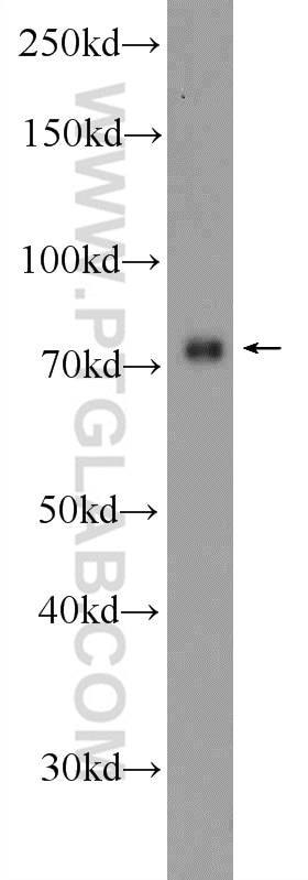 Western Blot (WB) analysis of SH-SY5Y cells using ZNF549 Polyclonal antibody (25592-1-AP)