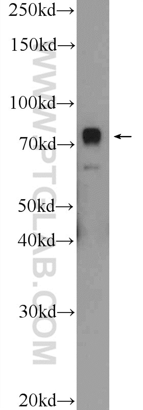 Western Blot (WB) analysis of HeLa cells using ZNF549 Polyclonal antibody (25592-1-AP)