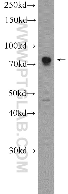 Western Blot (WB) analysis of SMMC-7721 cells using ZNF549 Polyclonal antibody (25592-1-AP)