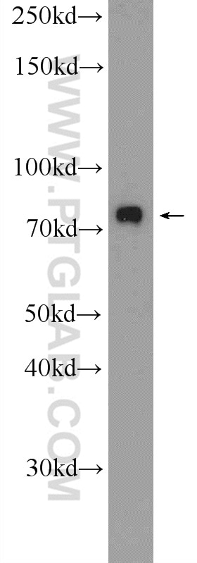 Western Blot (WB) analysis of A549 cells using ZNF549 Polyclonal antibody (25592-1-AP)