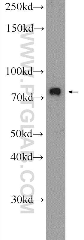 WB analysis of A549 using 25592-1-AP