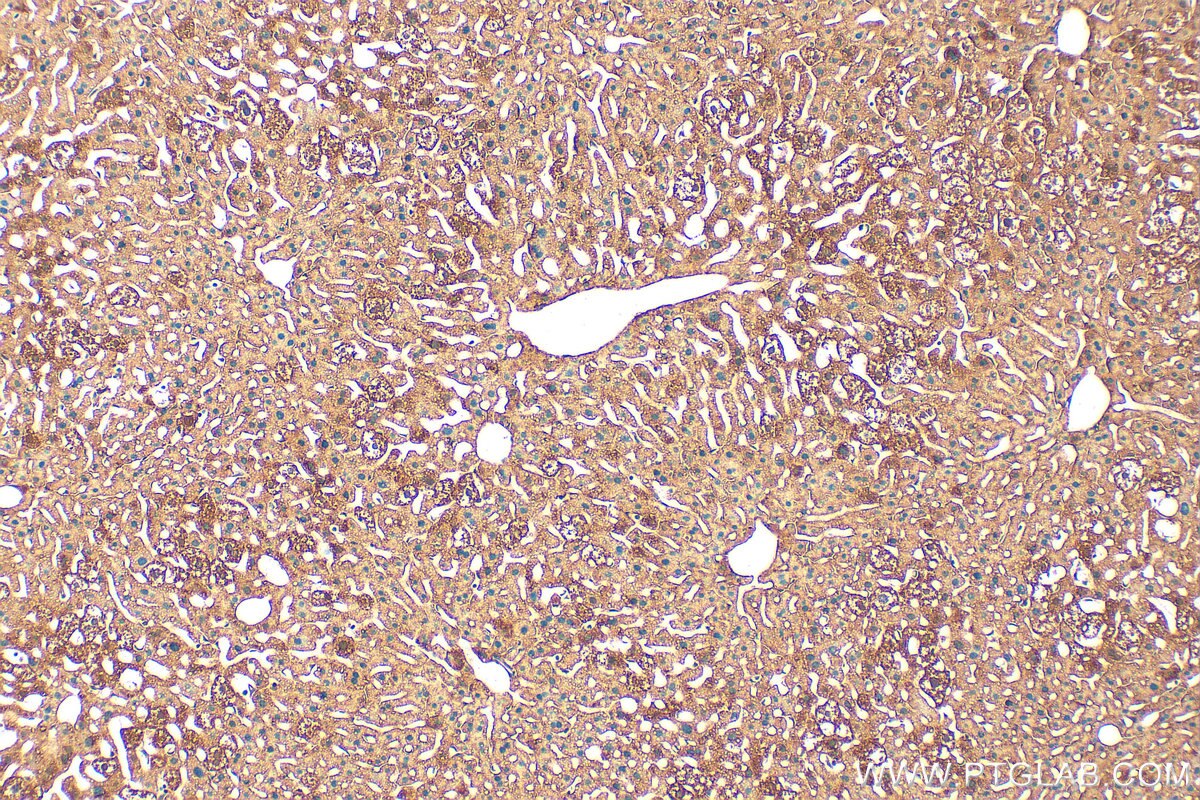 Immunohistochemistry (IHC) staining of mouse liver tissue using ZNF551 Polyclonal antibody (33216-1-AP)