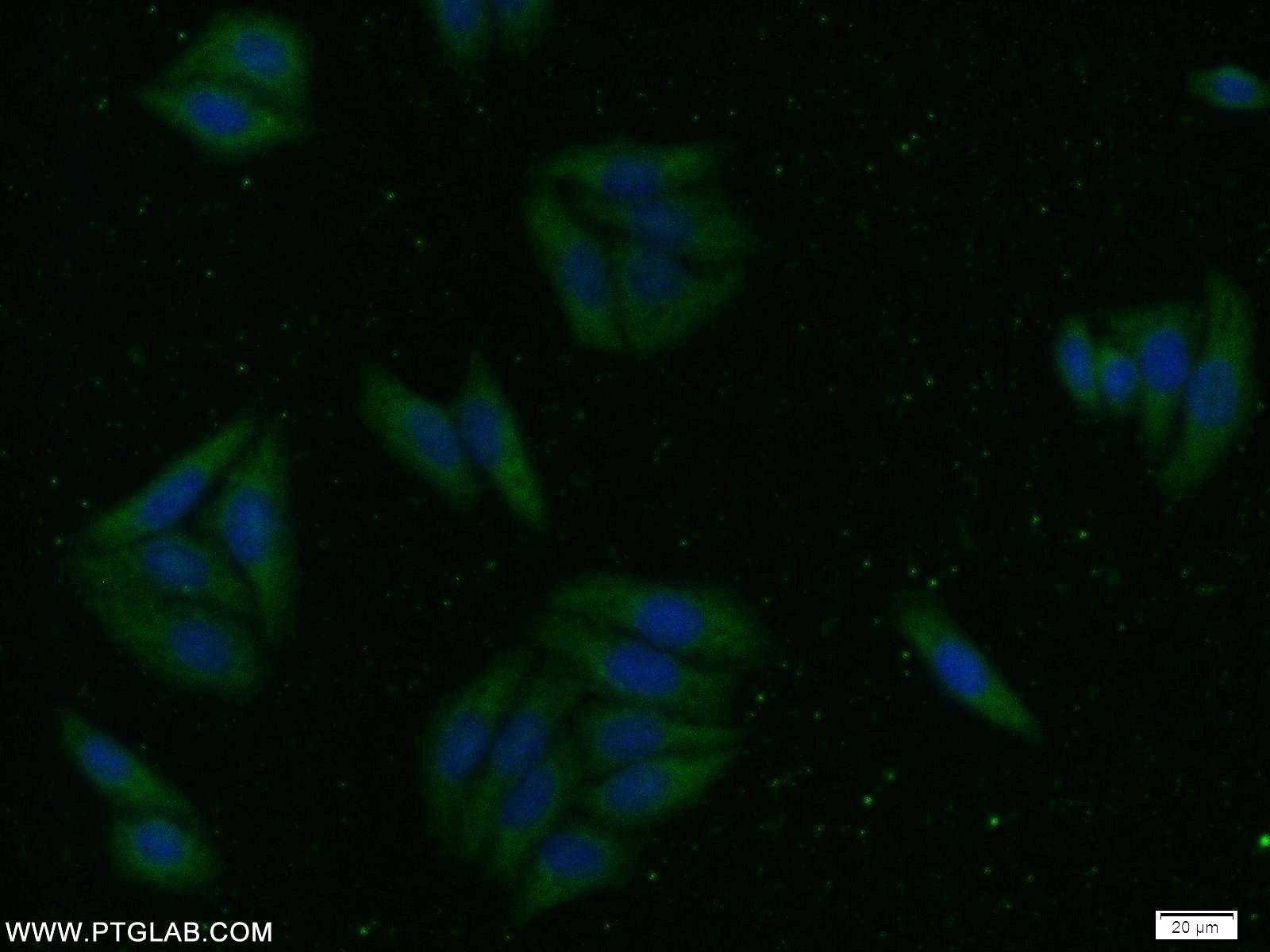 Immunofluorescence (IF) / fluorescent staining of HepG2 cells using ZNF557 Polyclonal antibody (20500-1-AP)