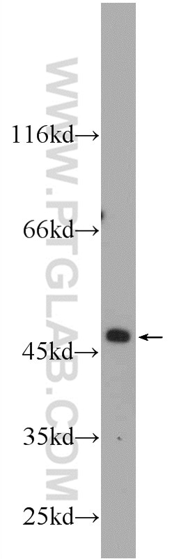 Western Blot (WB) analysis of HepG2 cells using ZNF557 Polyclonal antibody (20500-1-AP)