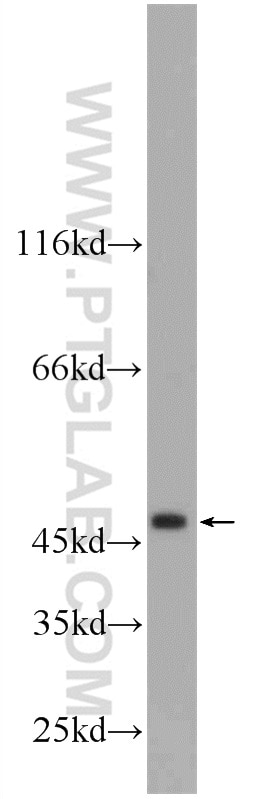 Western Blot (WB) analysis of HeLa cells using ZNF557 Polyclonal antibody (20500-1-AP)