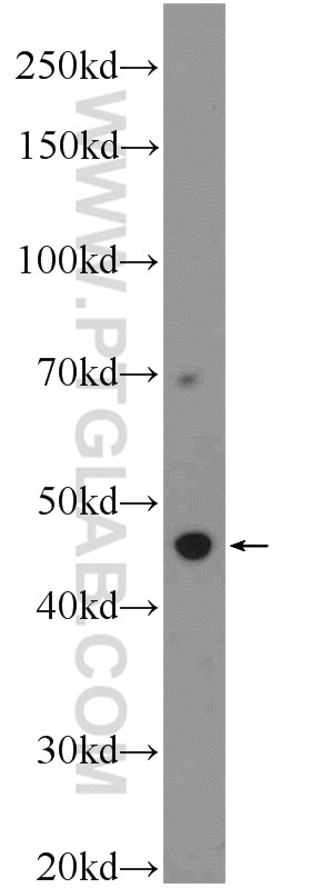 Western Blot (WB) analysis of A549 cells using ZNF557 Polyclonal antibody (20500-1-AP)