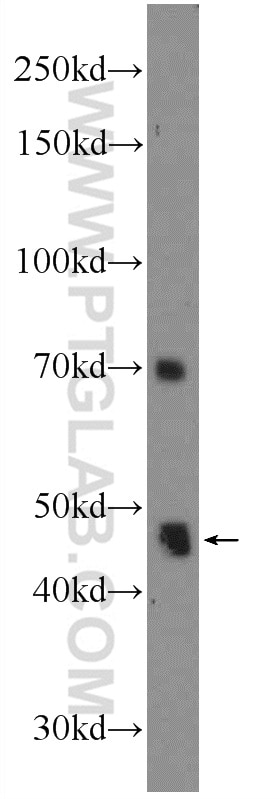 Western Blot (WB) analysis of COLO 320 cells using ZNF557 Polyclonal antibody (20500-1-AP)