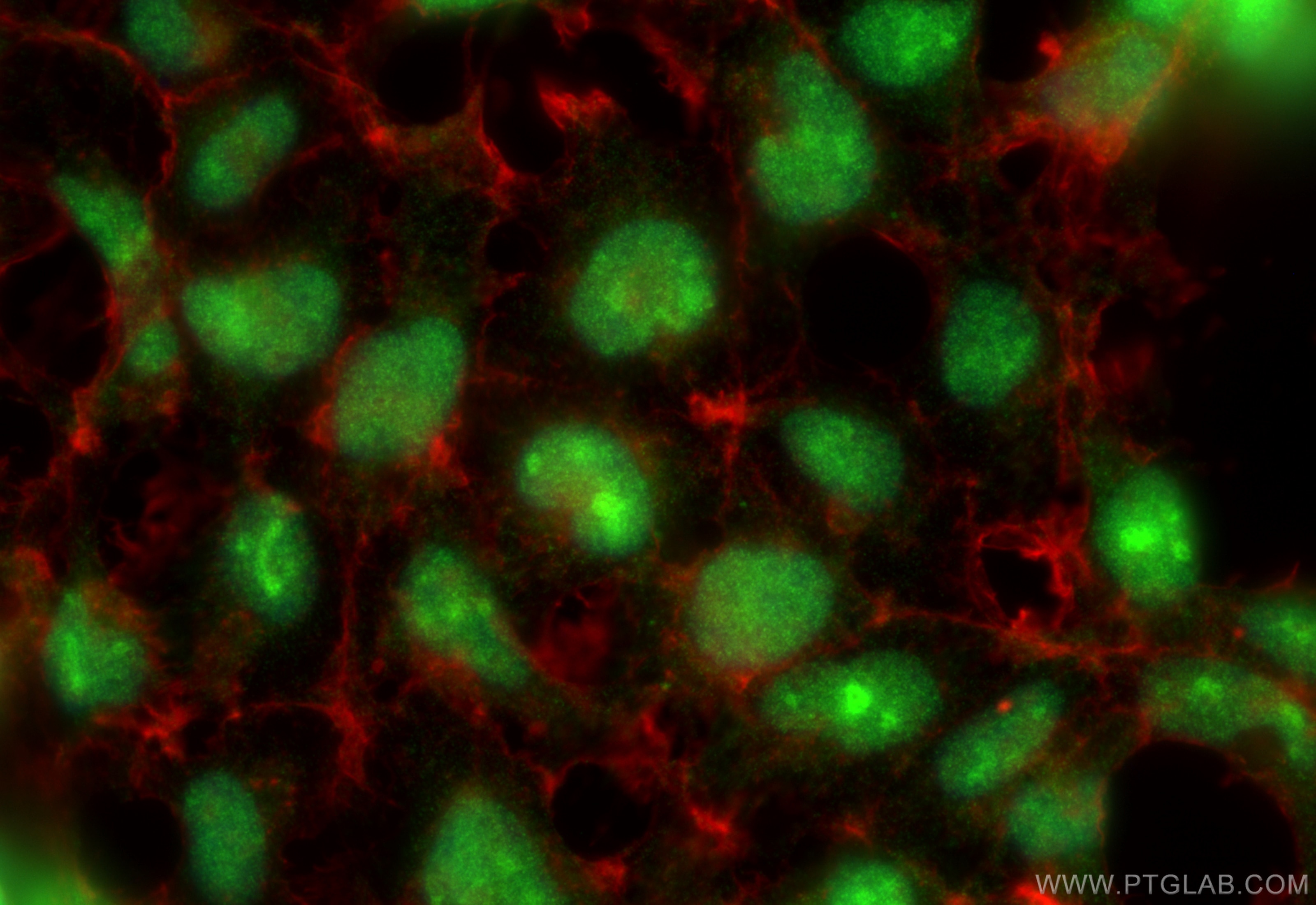 IF Staining of HEK-293 using 21980-1-AP (same clone as 21980-1-PBS) Immunofluorescence (IF) / fluorescent staining of HEK-293 cells using ZNF560 Polyclonal antibody (21980-1-AP)