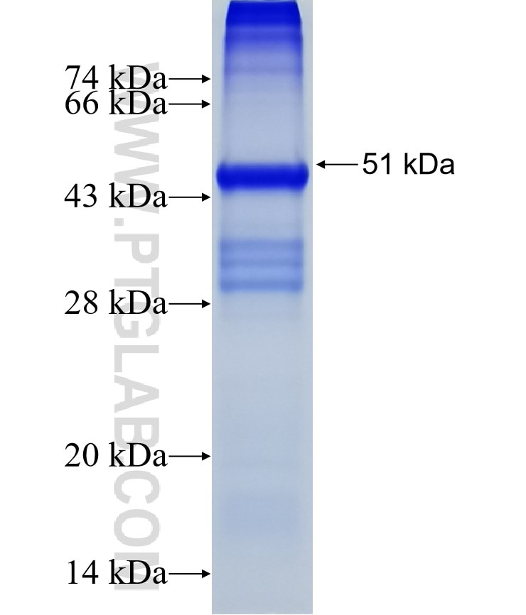ZNF562 fusion protein Ag37785 SDS-PAGE ZNF562 fusion protein Ag37785 SDS-PAGE