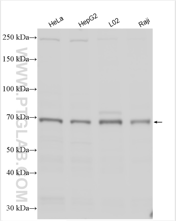 Western Blot (WB) analysis of various lysates using ZNF570 Polyclonal antibody (27811-1-AP)