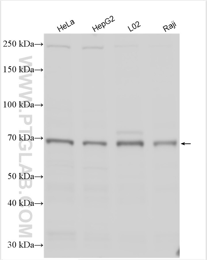 Western Blot (WB) analysis of various lysates using ZNF570 Polyclonal antibody (27811-1-AP)