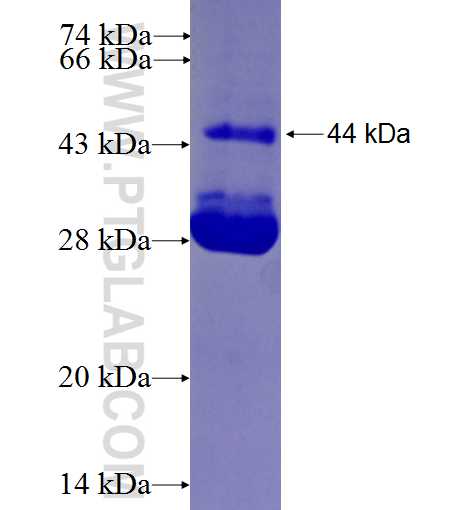 ZNF570 fusion protein Ag26925 SDS-PAGE