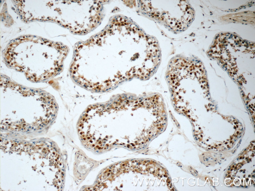 Immunohistochemistry (IHC) staining of human testis tissue using ZNF571 Polyclonal antibody (25302-1-AP)