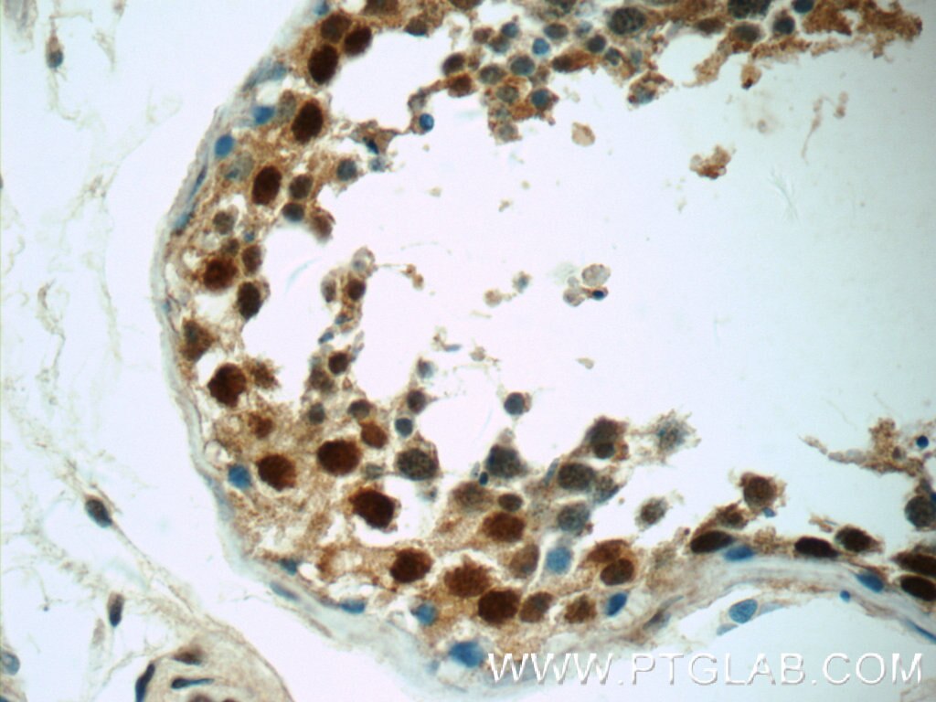 Immunohistochemistry (IHC) staining of human testis tissue using ZNF571 Polyclonal antibody (25302-1-AP)