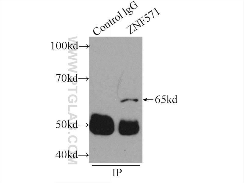 Immunoprecipitation (IP) experiment of MCF-7 cells using ZNF571 Polyclonal antibody (25302-1-AP)