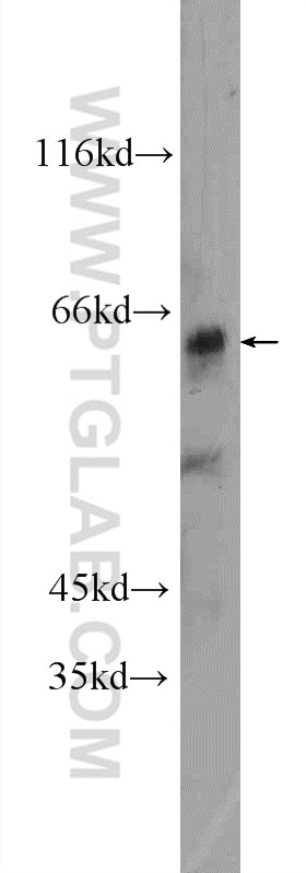 Western Blot (WB) analysis of HeLa cells using ZNF571 Polyclonal antibody (25302-1-AP)