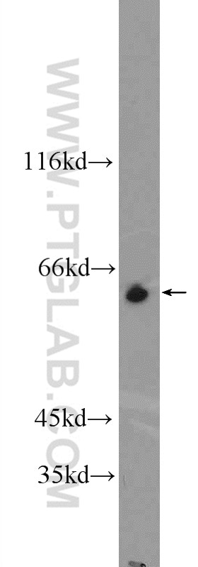 Western Blot (WB) analysis of MCF-7 cells using ZNF571 Polyclonal antibody (25302-1-AP)