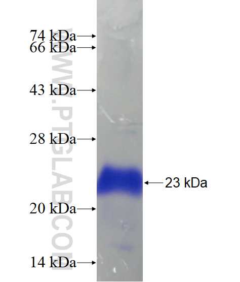 ZNF571 fusion protein Ag18151 SDS-PAGE