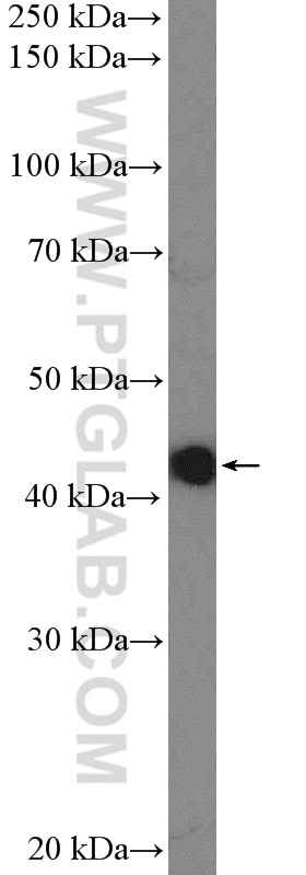 Western Blot (WB) analysis of A549 cells using ZNF572 Polyclonal antibody (23922-1-AP)