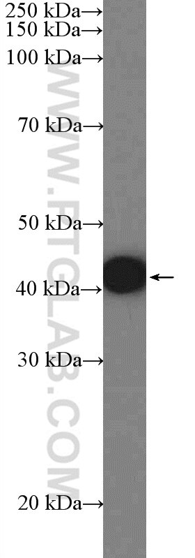 Western Blot (WB) analysis of HeLa cells using ZNF572 Polyclonal antibody (23922-1-AP)