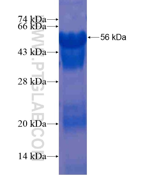 ZNF572 fusion protein Ag21052 SDS-PAGE