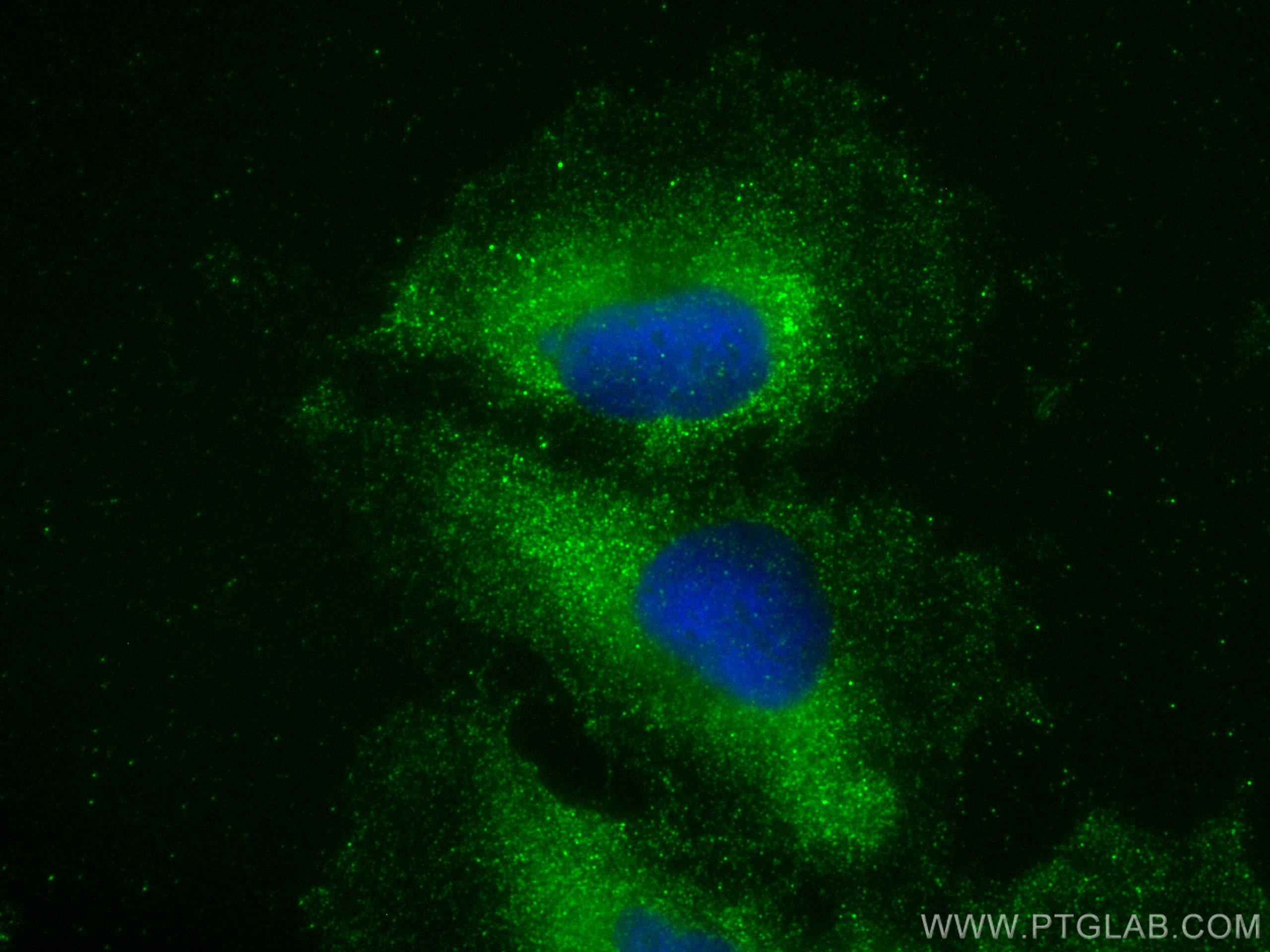 Immunofluorescence (IF) / fluorescent staining of U-251 cells using ZNF573 Polyclonal antibody (24755-1-AP)