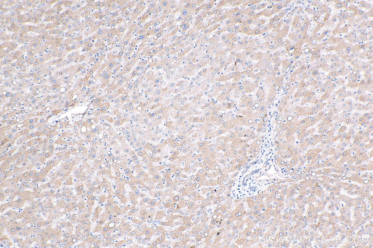 Immunohistochemistry (IHC) staining of human liver tissue using ZNF573 Polyclonal antibody (24755-1-AP)