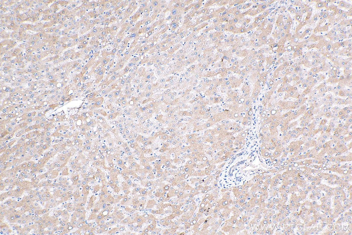 IHC staining of human liver using 24755-1-AP