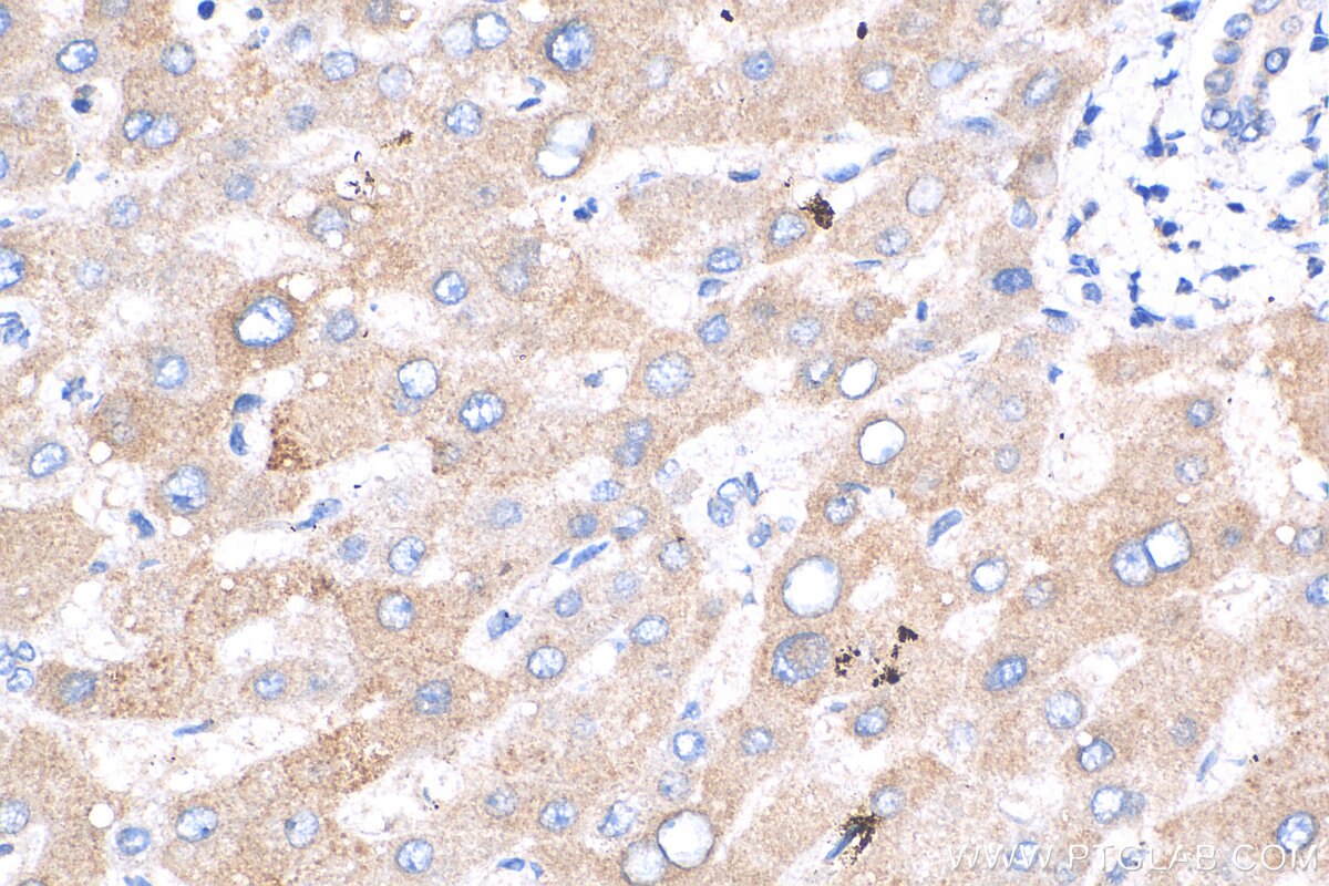 Immunohistochemistry (IHC) staining of human liver tissue using ZNF573 Polyclonal antibody (24755-1-AP)