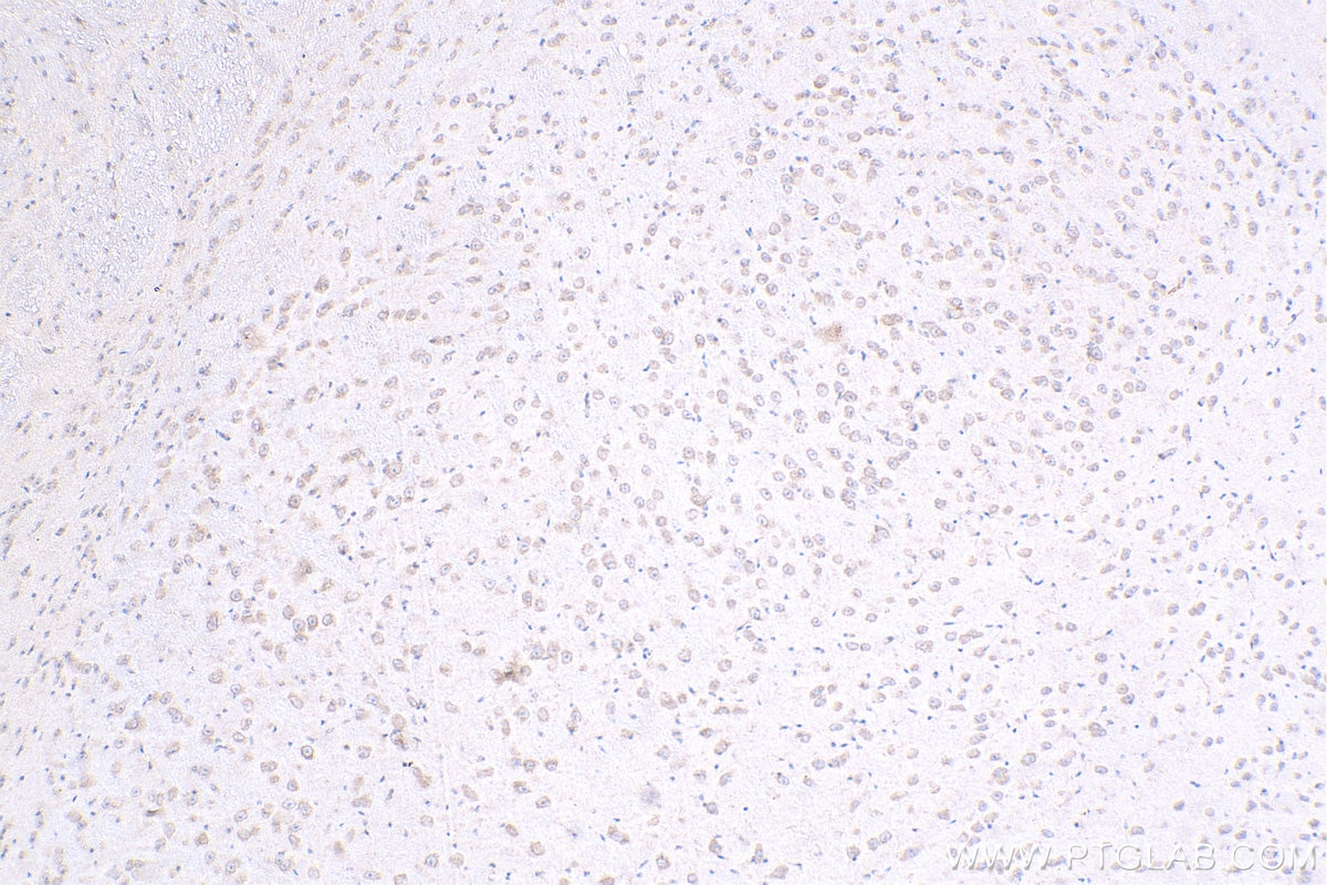 Immunohistochemistry (IHC) staining of mouse brain tissue using ZNF573 Polyclonal antibody (24755-1-AP)