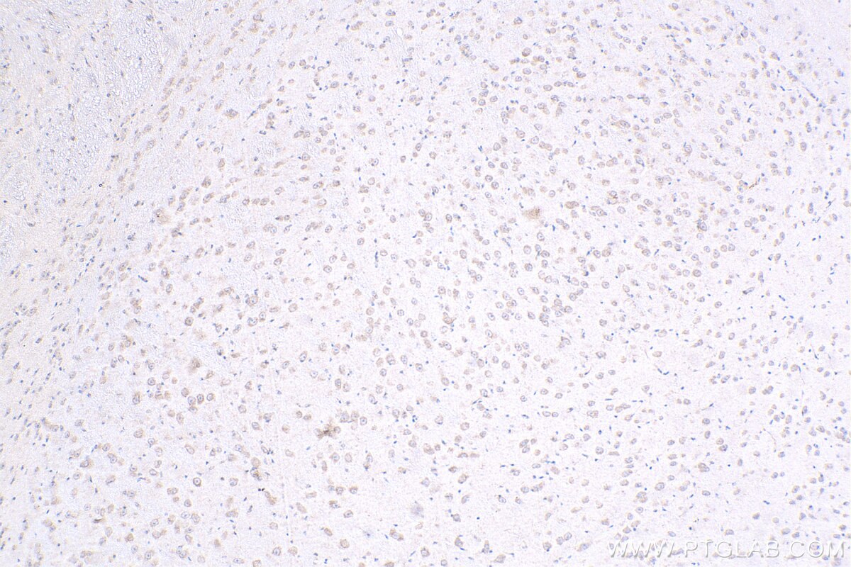 IHC staining of mouse brain using 24755-1-AP