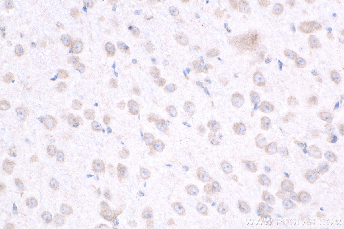 IHC staining of mouse brain using 24755-1-AP