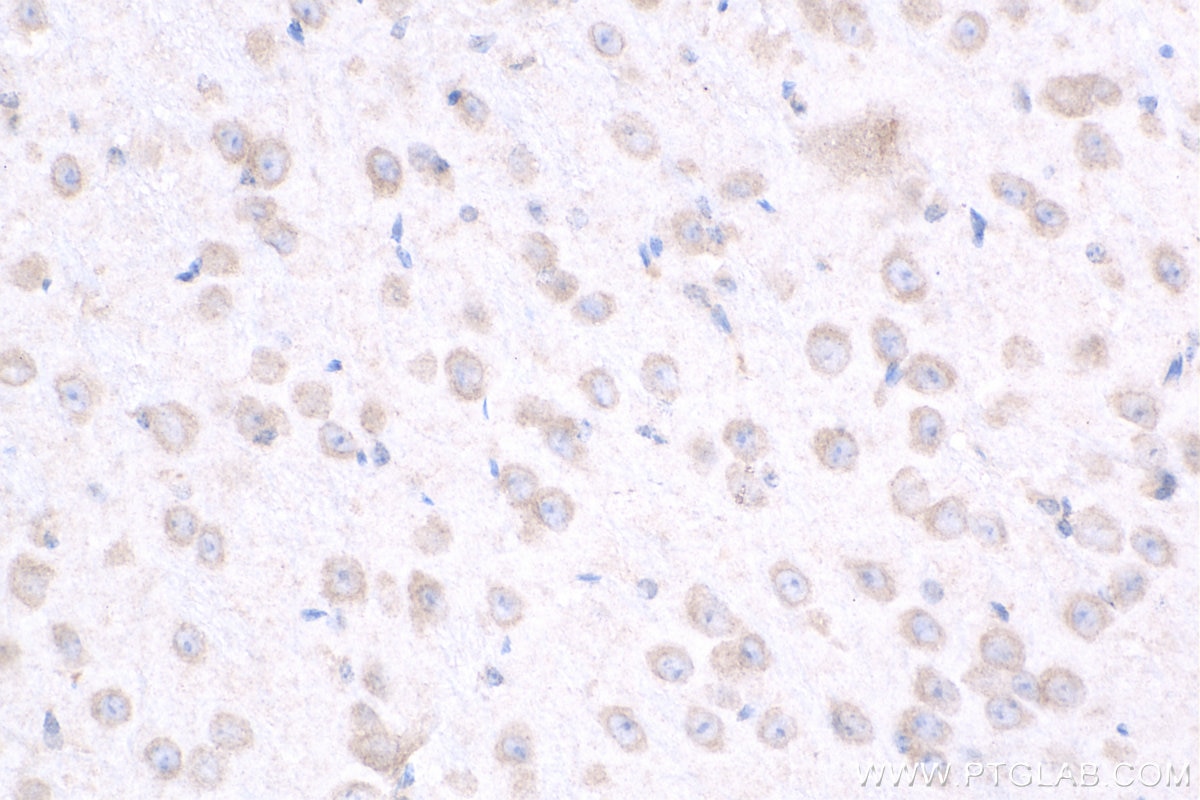 Immunohistochemistry (IHC) staining of mouse brain tissue using ZNF573 Polyclonal antibody (24755-1-AP)