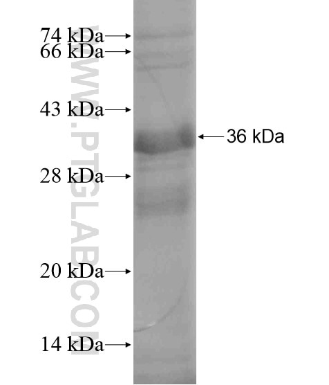 ZNF573 fusion protein Ag20475 SDS-PAGE