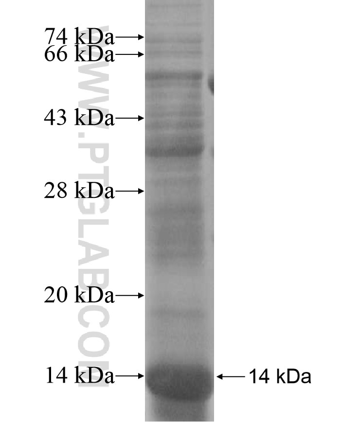 ZNF582 fusion protein Ag17230 SDS-PAGE