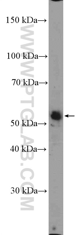 Western Blot (WB) analysis of HepG2 cells using ZNF586 Polyclonal antibody (25023-1-AP)