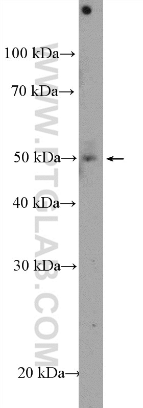 Western Blot (WB) analysis of COLO 320 cells using ZNF586 Polyclonal antibody (25023-1-AP)