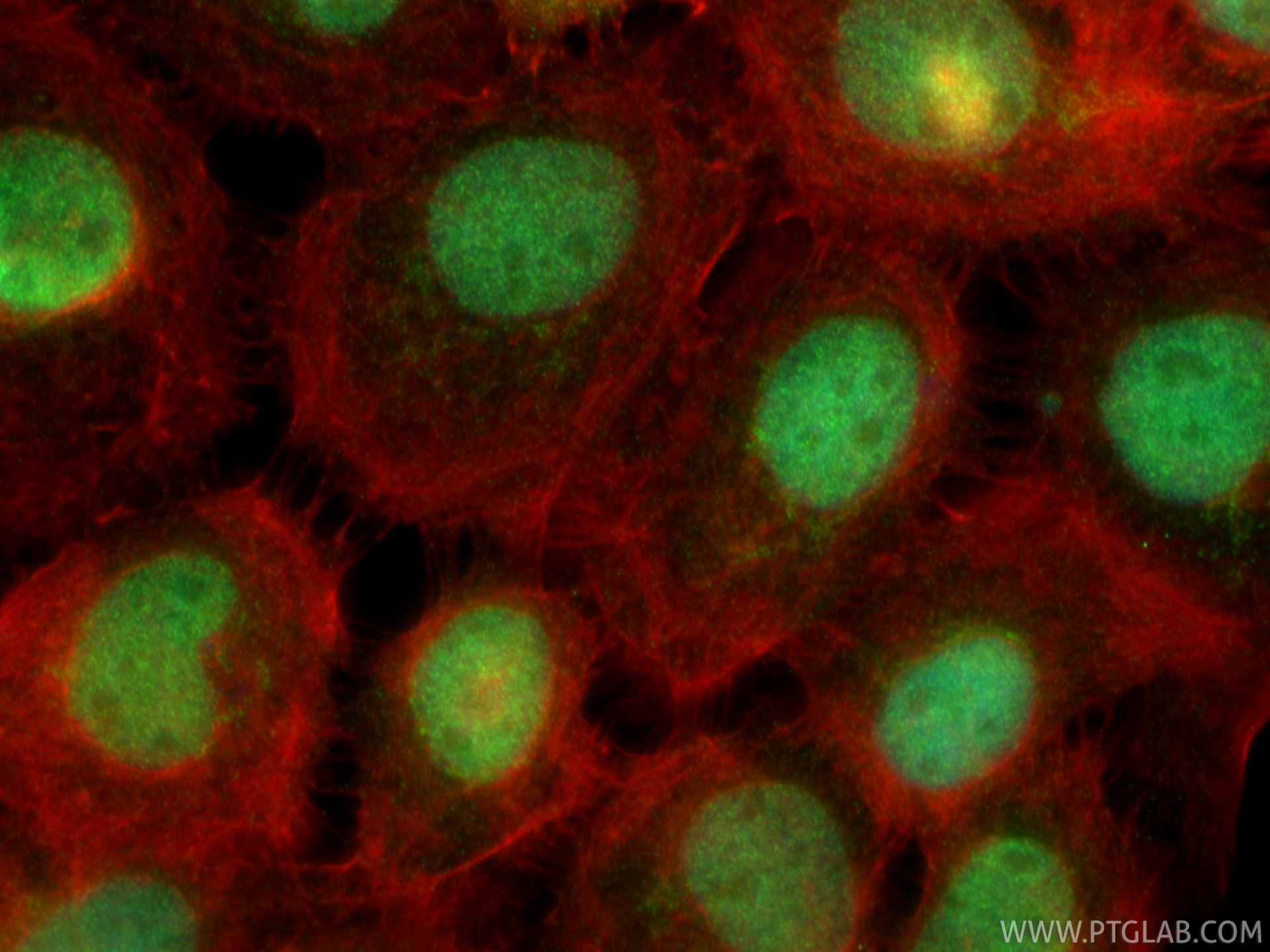 IF Staining of A431 using 33033-1-AP (same clone as 33033-1-PBS) Immunofluorescence (IF) / fluorescent staining of A431 cells using ZNF589 Polyclonal antibody (33033-1-AP)