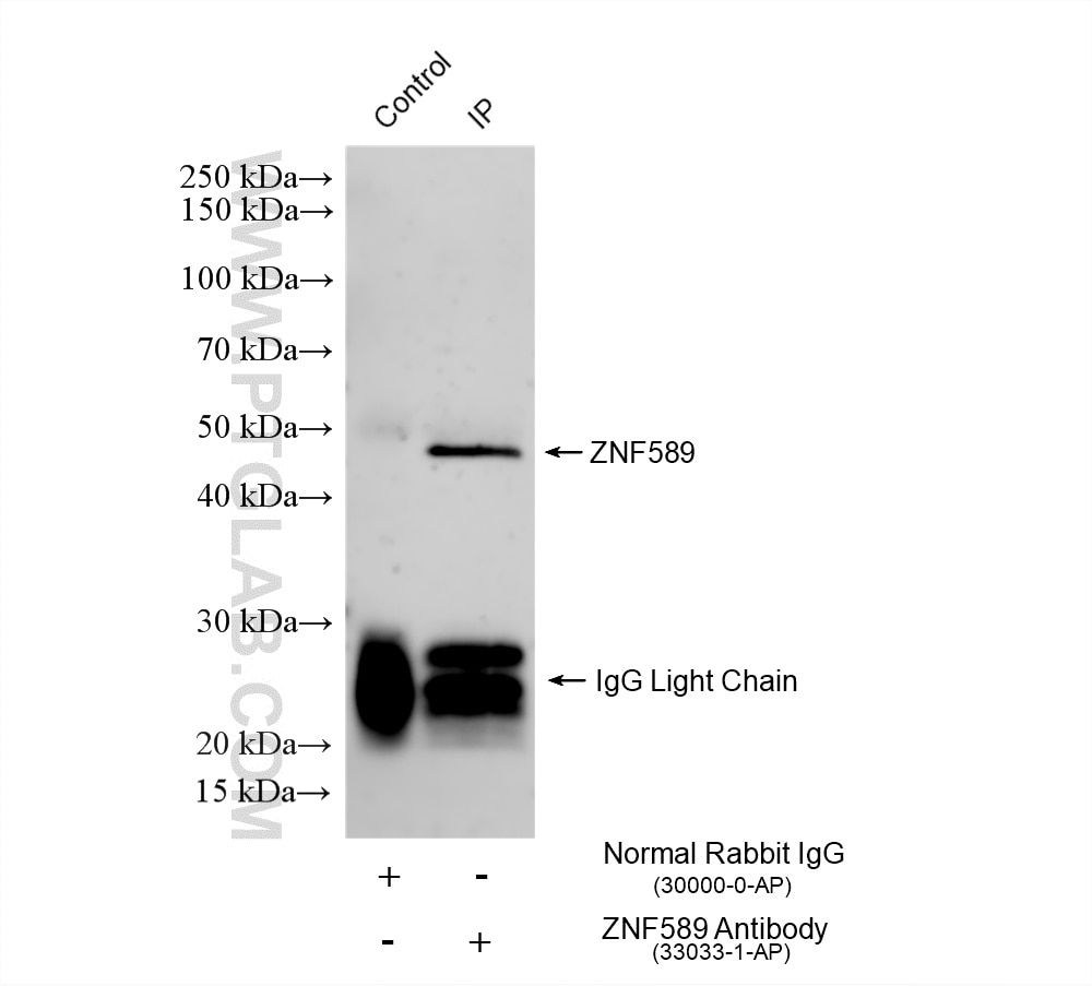 IP result of anti-ZNF589 (IP:33033-1-AP, 4ug; Detection:33033-1-AP 1:600) with mouse liver tissue lysate 2480 ug. Immunoprecipitation (IP) experiment of mouse liver tissue using ZNF589 Polyclonal antibody (33033-1-AP)