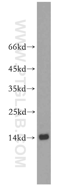 Western Blot (WB) analysis of mouse spleen tissue using ZNF593 Polyclonal antibody (19426-1-AP)