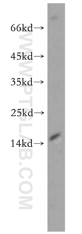 Western Blot (WB) analysis of PC-3 cells using ZNF593 Polyclonal antibody (19426-1-AP)